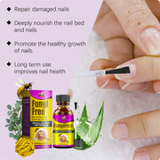Bee Venom Nail Fungus Solution 10ml Each BUY 1 GET 1 FREE